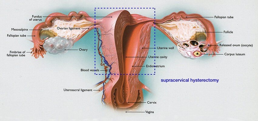 cigcsupra